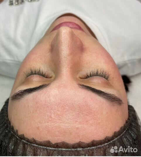 Чистка лица/пилинг biorepeel