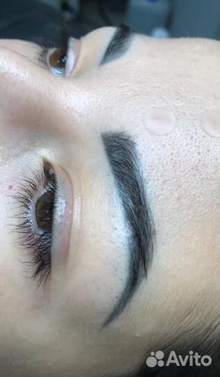 Лазерное удаление пм и татуировок