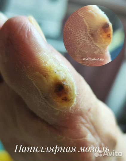 Подолог, педикюр, ортопедические стельки, обучение