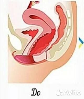 Интимное востановление-омоложение