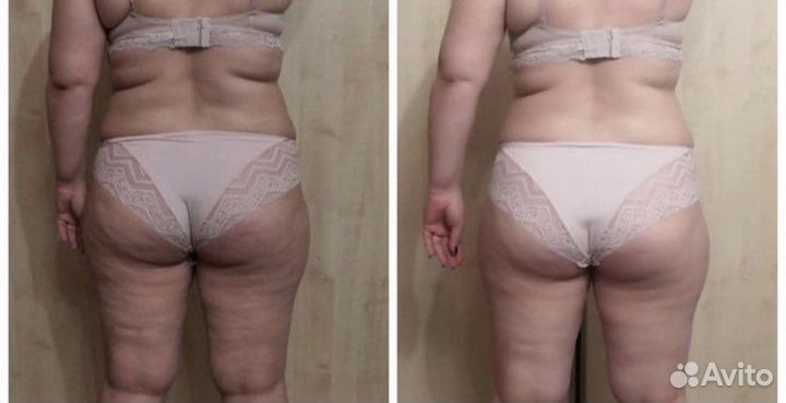 Массаж антицеллюлитный, лица