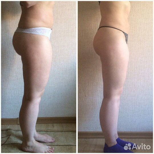 Аппаратная коррекция фигуры