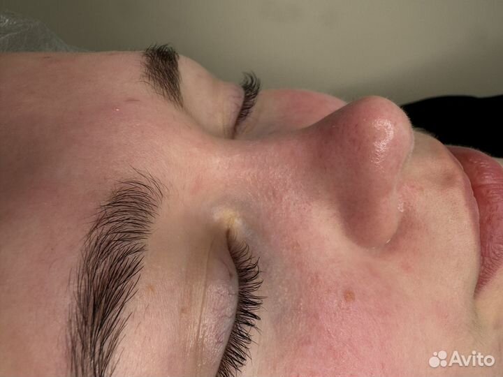 Услуги косметолога эстетиста