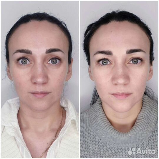 Скульптурный массаж лица