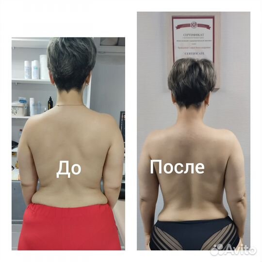 Модель на массаж