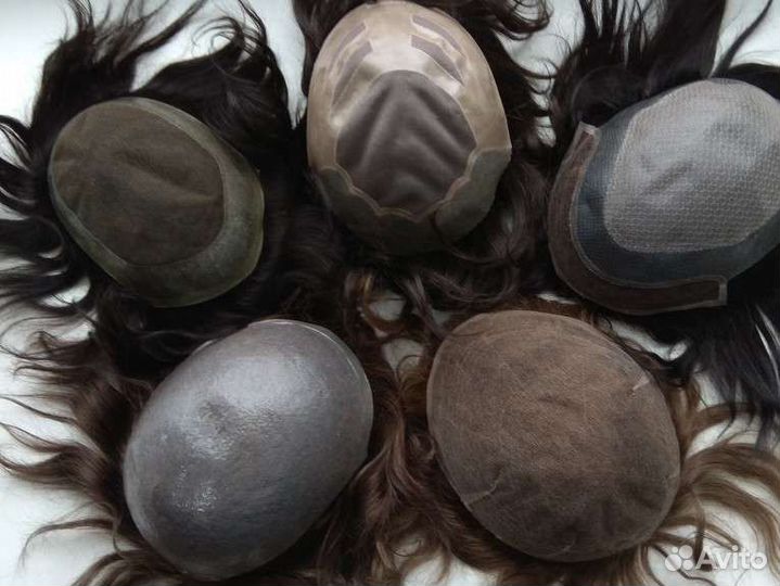 Система замещения волос