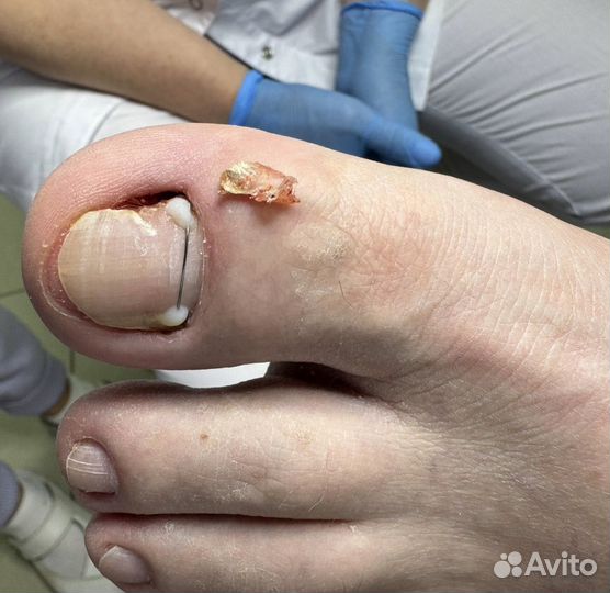 Мастер педикюра. подолог на дом