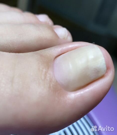 Педикюр с покрытием лаком