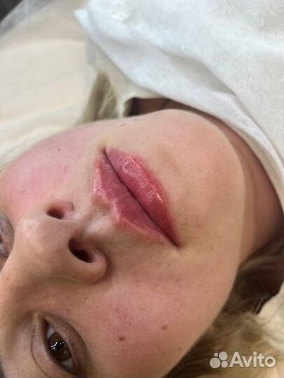 Врач - косметолог