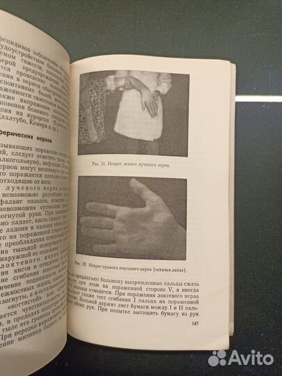 Болезни нервной системы. Ерохина. 1975