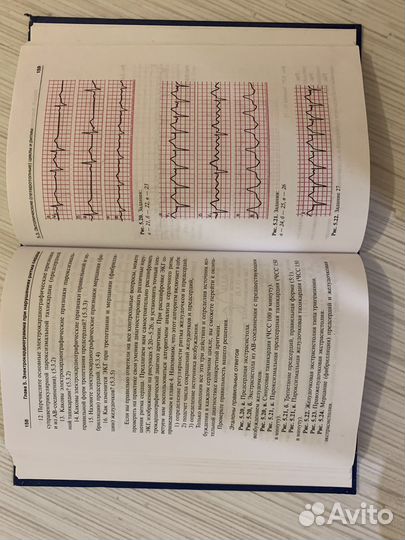 Экг диагностика Струтынский