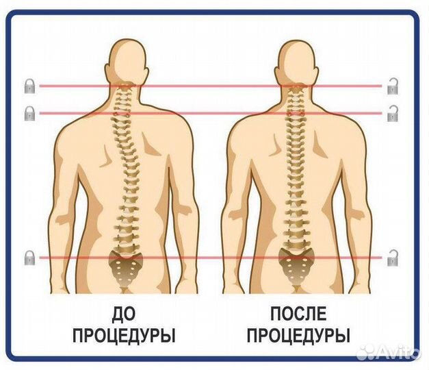 Правка Атланта
