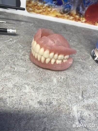 Срочный ремонт зубных протезов В Москве