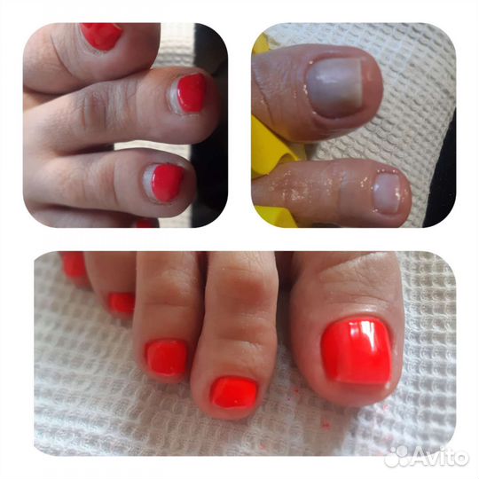 Аппаратный маникюр