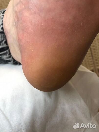 Педикюр с выездом на дом