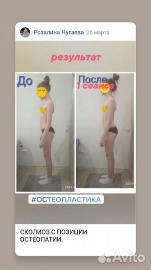 Лечебный массаж Остеопластика по метод Виталия Ким