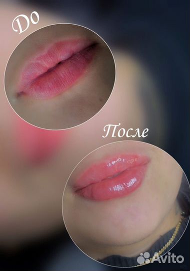 Косметологические процедуры