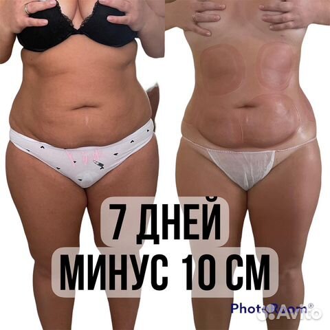 Похудение/липосоник/массаж