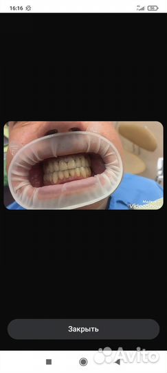 Услуги зубного техника