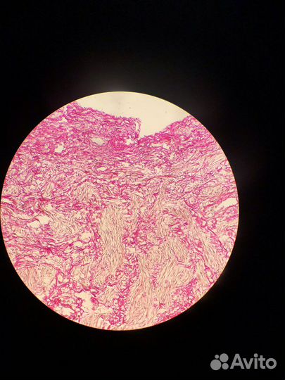 Изготовление гистологических препаратов