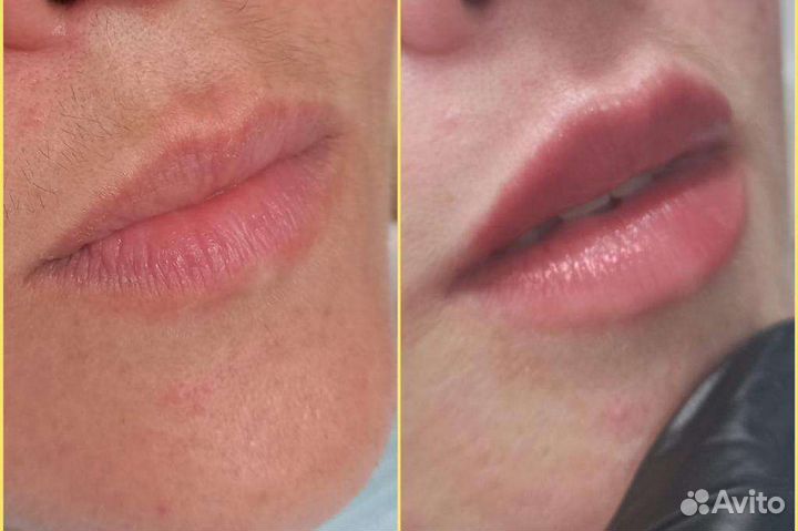 Услуги косметолога