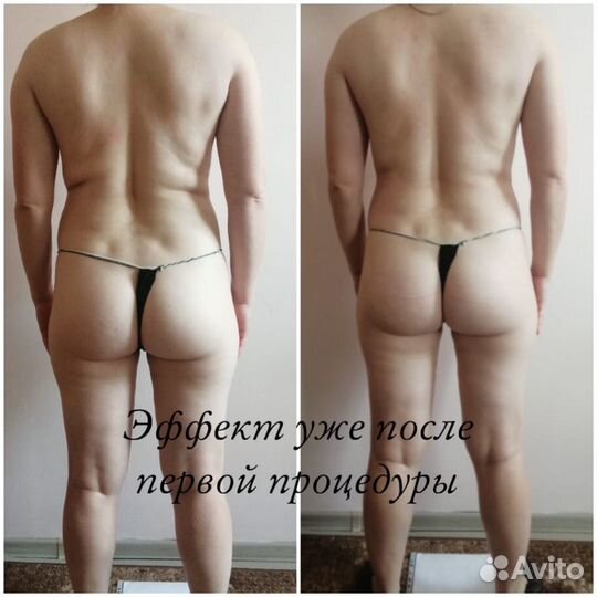 Массаж. Коррекция фигуры. Похудение