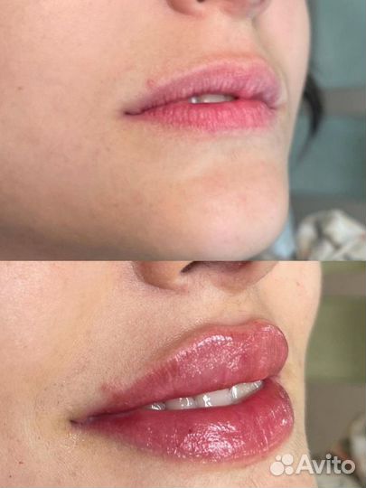 Услуги косметолога