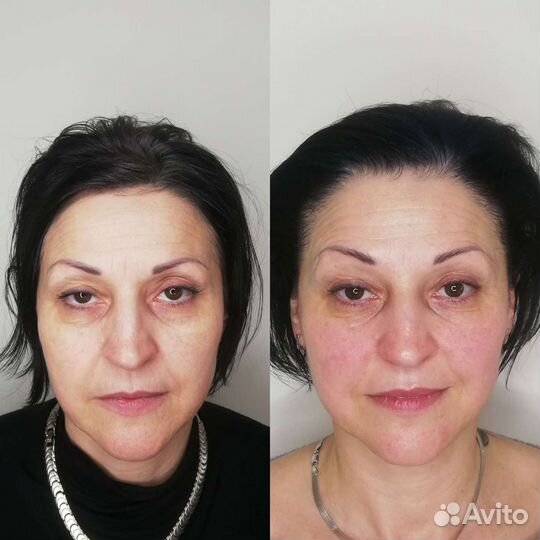 Омолаживающий Массаж лица