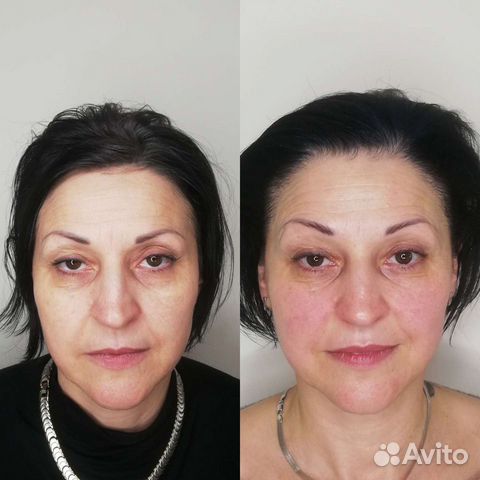 Омолаживающий Массаж лица