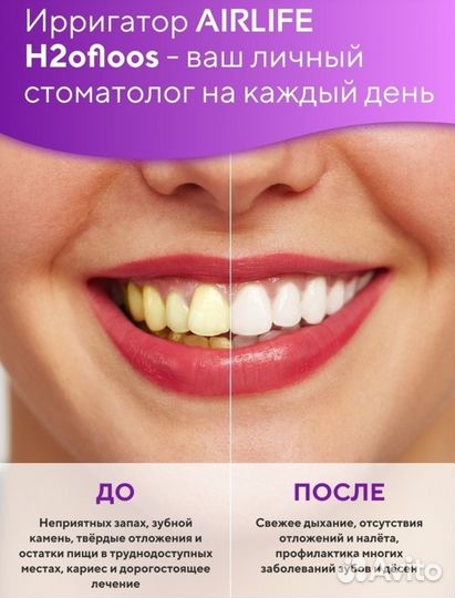 Ирригатор беспроводной 10 насадок