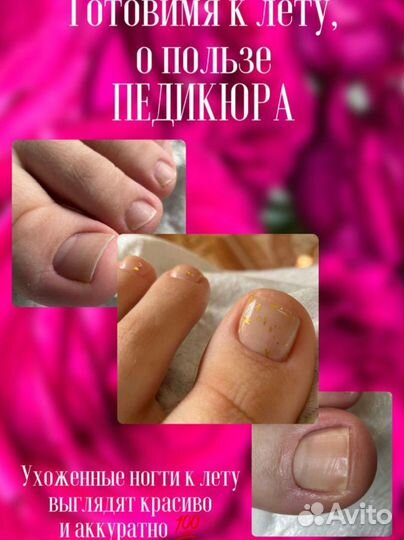 Педикюр Шугаринг