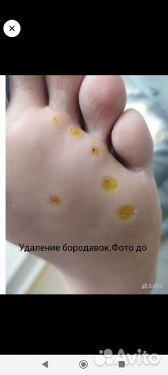 Педикюр,маникюр,подолог,выезд на дом