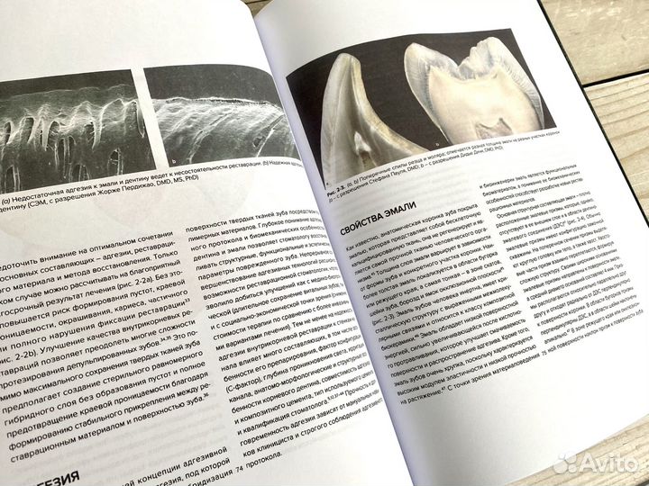 Внутрикорневые реставрации