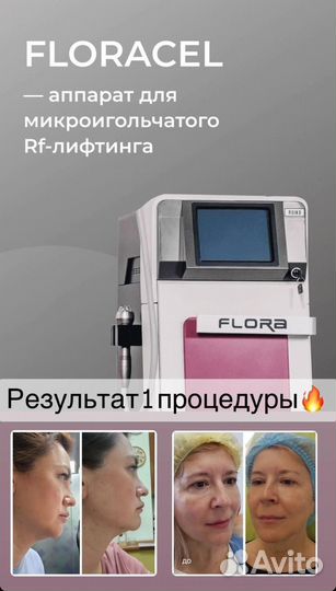 Микроигольчатый лифтинг Floracel