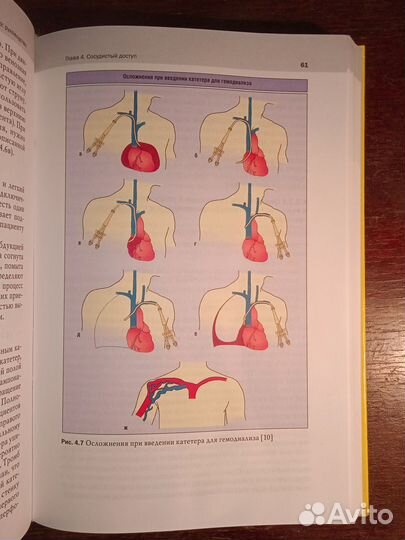 Клинический Диализ руководство. Сумел Ахмад