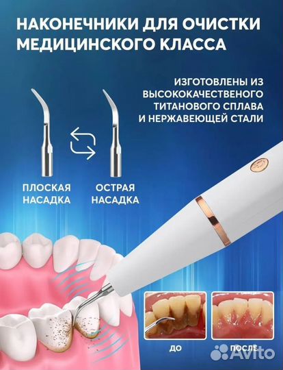 Ультразвуковой скалер