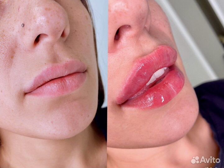 Врач косметолог