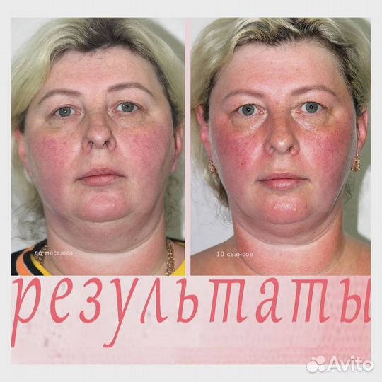 Массаж лица