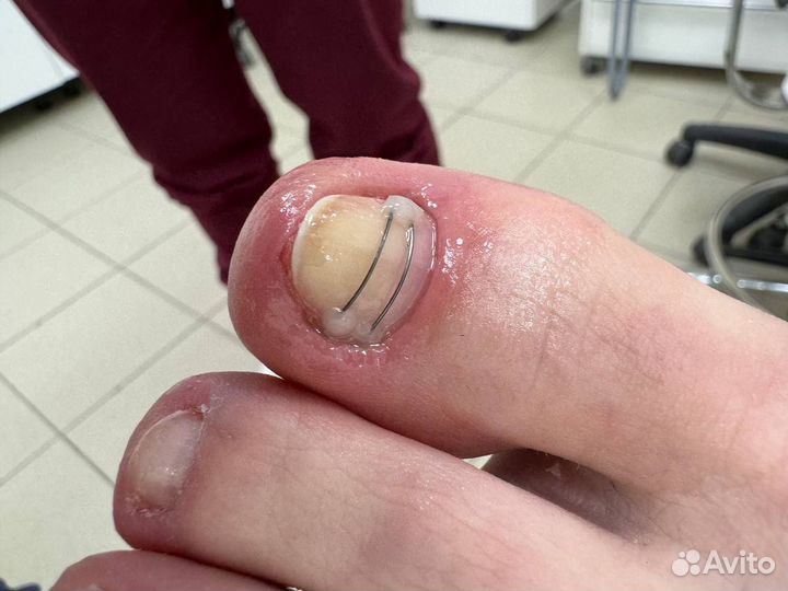 Модель к подологу