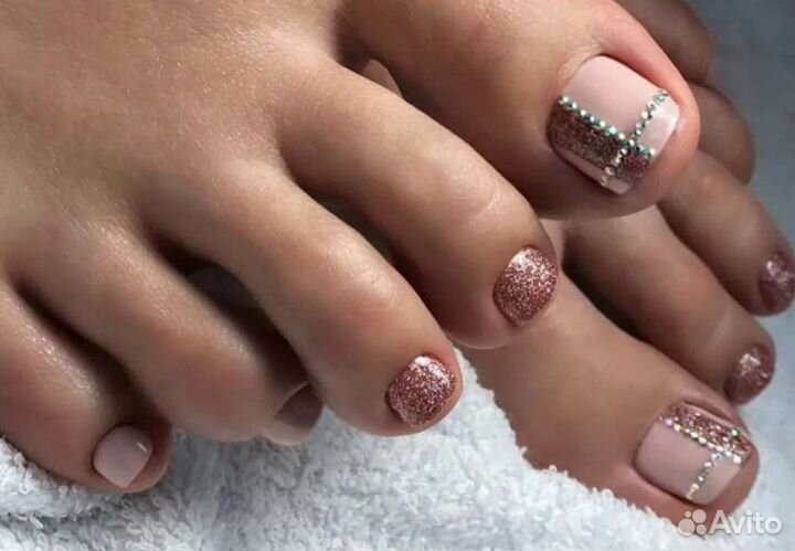 Педикюр Титановая нить Вросший ноготь Онихолизис