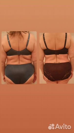 Lpg массаж по маслу