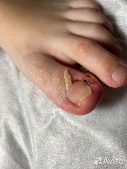 Подолог. Медицинский педикюр.Сергиев Посад