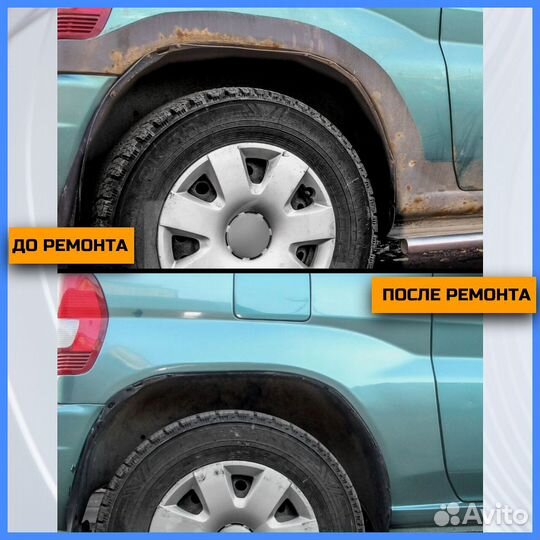 Ремонтные арки Hyundai Santa Fe 1