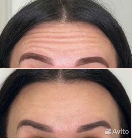 Услуги косметолога