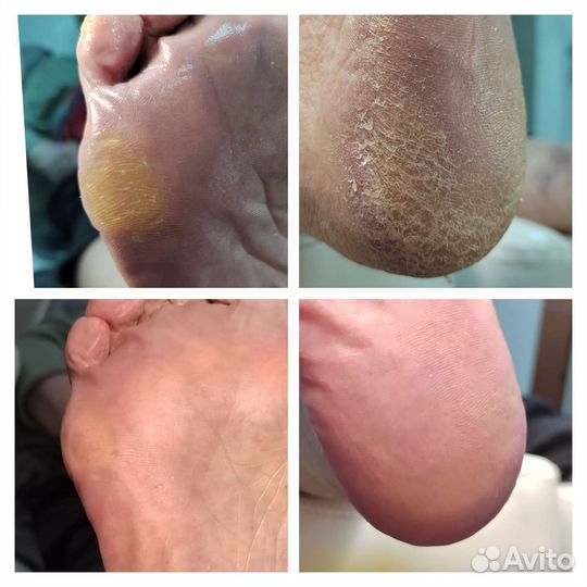 Подолог сормово