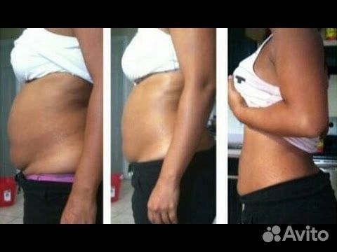 Массаж антицеллюлитный, мадейратерапия, коррекция