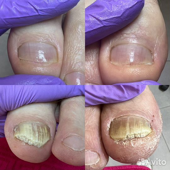 Услуги подолога