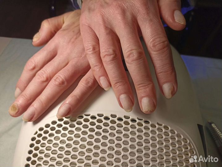 Педикюр подолог