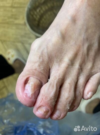 Услуги подолога,маникюр,педикюр