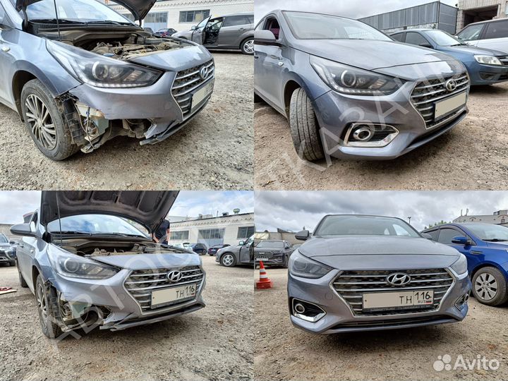 Бампер в цвет на Hyundai Solaris